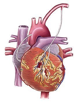 Free Bypass (CABG) In Jabalpur